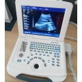 Clinic Blasenscanner Preise &amp; tragbare Ultraschall-Scan-Maschine